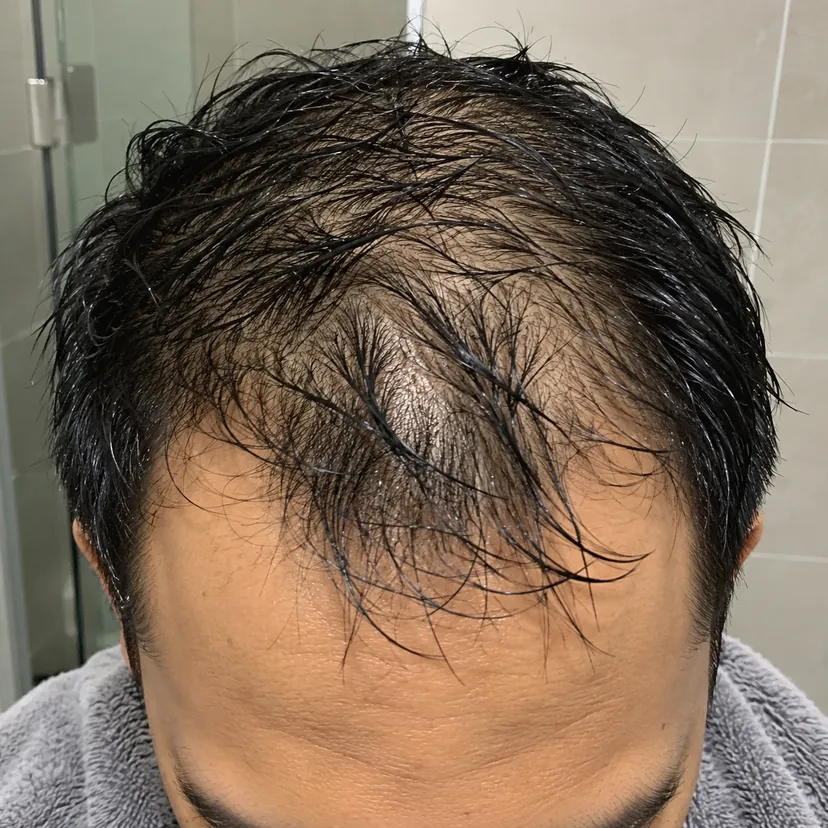 Rambut lelaki basah lepas mandi, kulit kepala nampak