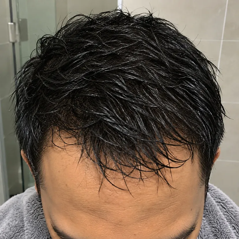 Rambut sama lepas mandi, padat dan kulit kepala tertutup
